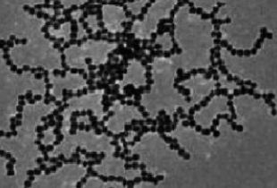 金納米鏈 金納米鏈