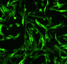 細(xì)胞轉(zhuǎn)染 細(xì)胞轉(zhuǎn)染