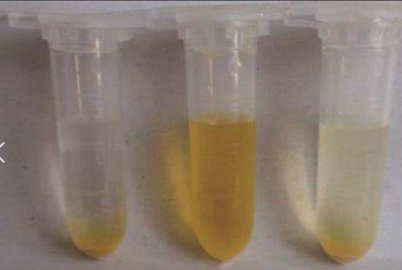 1-甲基-3-(3-磺酸基丙基)咪唑磷酸鹽([PSMIM]H2PO4)離子液體
