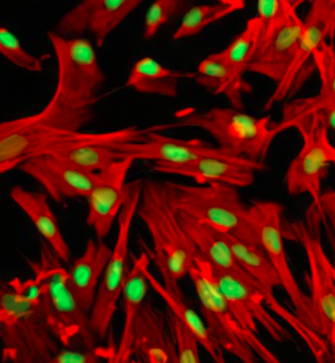 葡萄糖-四甲基羅丹明 葡萄糖-四甲基羅丹明